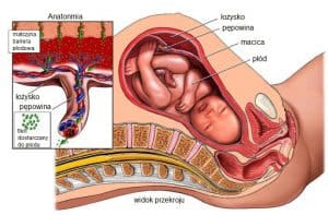 asfiksja u noworodka